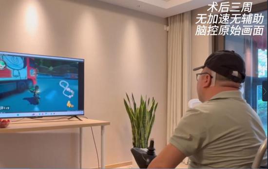 China successfully conducts clinical trial for invasive brain-computer interface